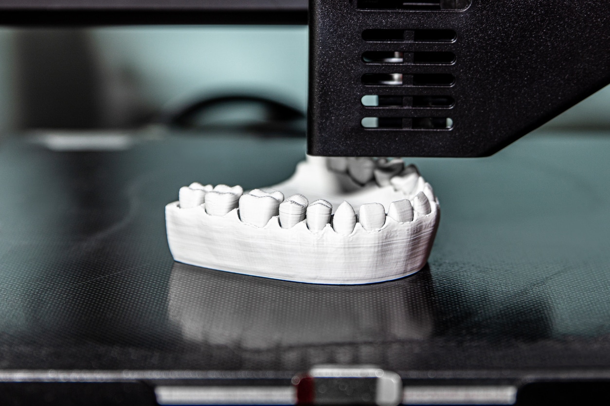 3D dental mold tray on dark background in Asheboro, NC