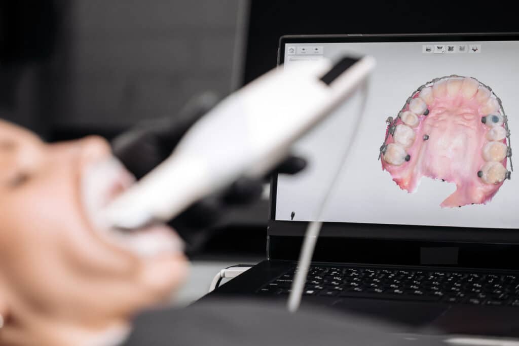 Orthodontist using scanner on dental mold in Asheboro, NC