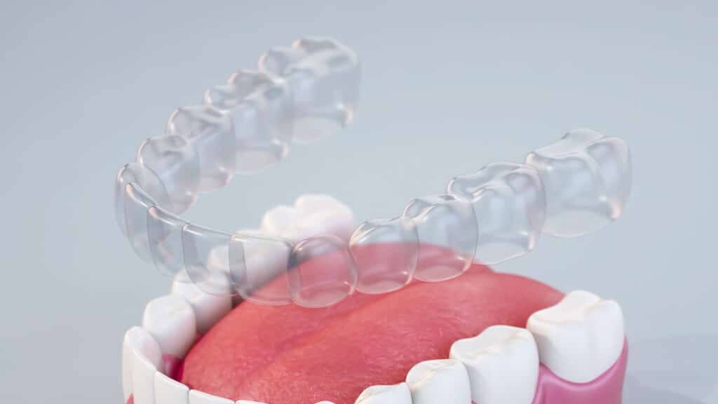 Close-up of teeth with red gum tissue dental model in Asheboro, NC